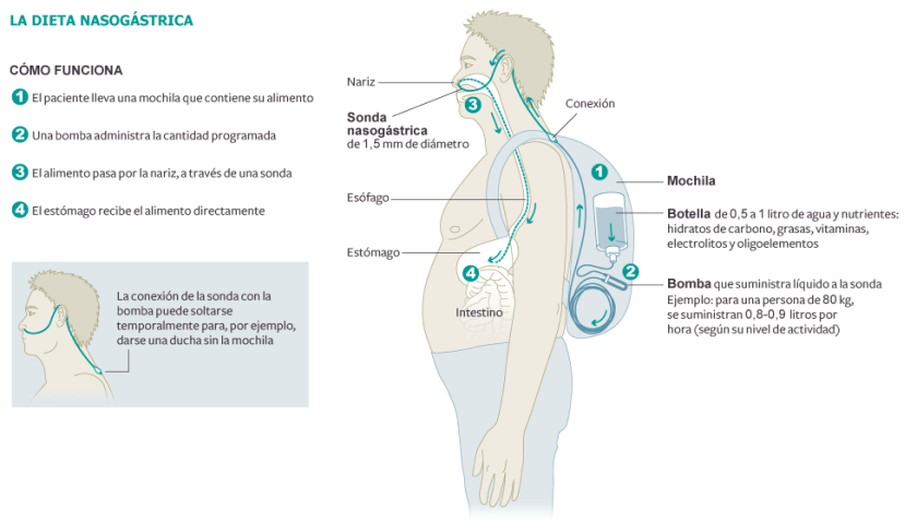 la dieta de la sonda