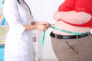 La reducción del estómago es la solución definitiva de la obesidad mórbida
