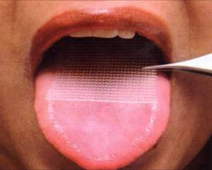 parche en la lengua, no tiene autorizaciones sanitarias en Europa