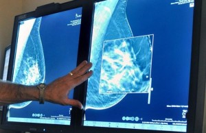 FILE - In this Tuesday July 31 2012 file photo a radiologist compares an image from earlier 2-D technology mammogram to the new 3-D Digital Breast Tomosynthesis mammography in Wichita Falls Texas The technology can detect much smaller cancers earlier Chances of dying from DCIS ductal carcinoma in situ a very early form of breast cancer are small but the disease is riskier for young women and blacks - disparities seen previously in more advanced cancer according to a large study published Thursday Aug 20 2015 in JAMA Oncology Torin Halsey Times Record News via AP mamografia